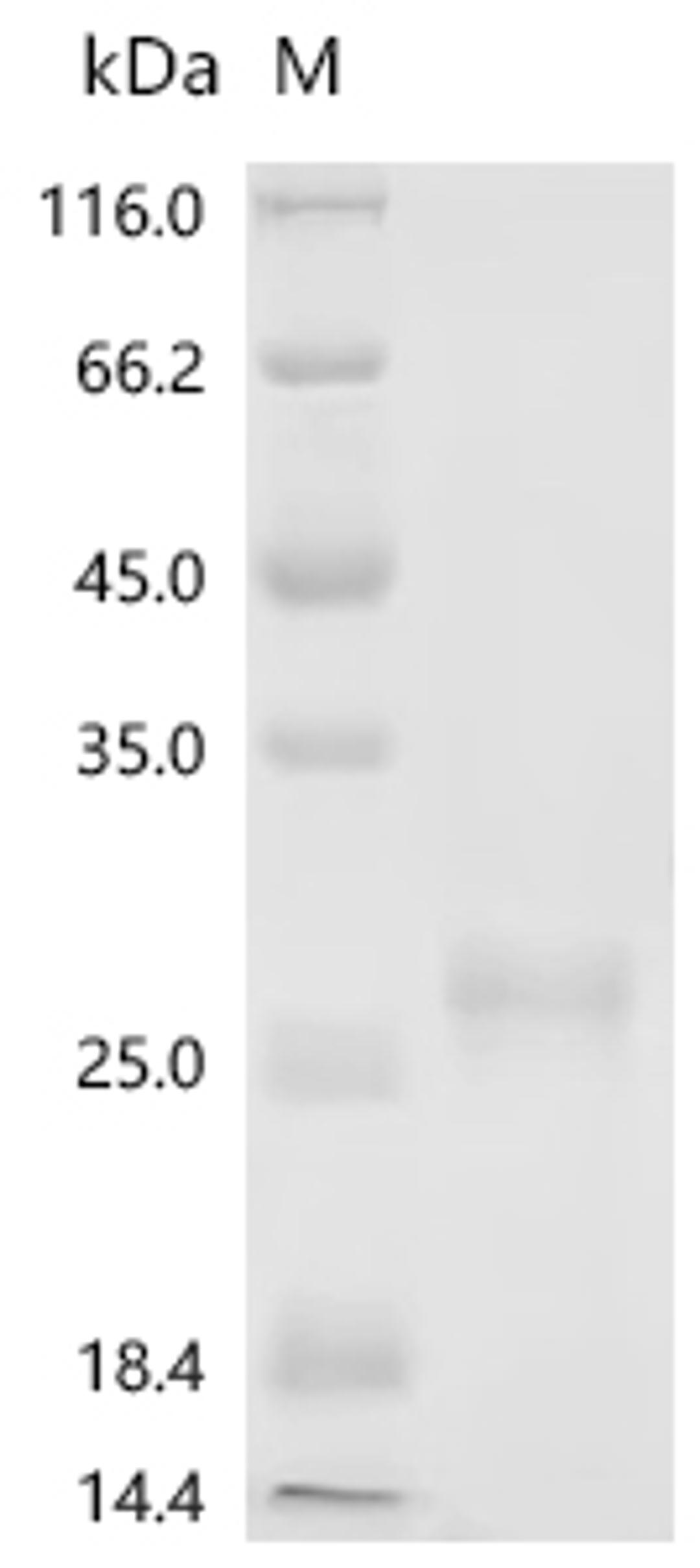(Tris-Glycine gel) Discontinuous SDS-PAGE (reduced) with 5% enrichment gel and 15% separation gel.