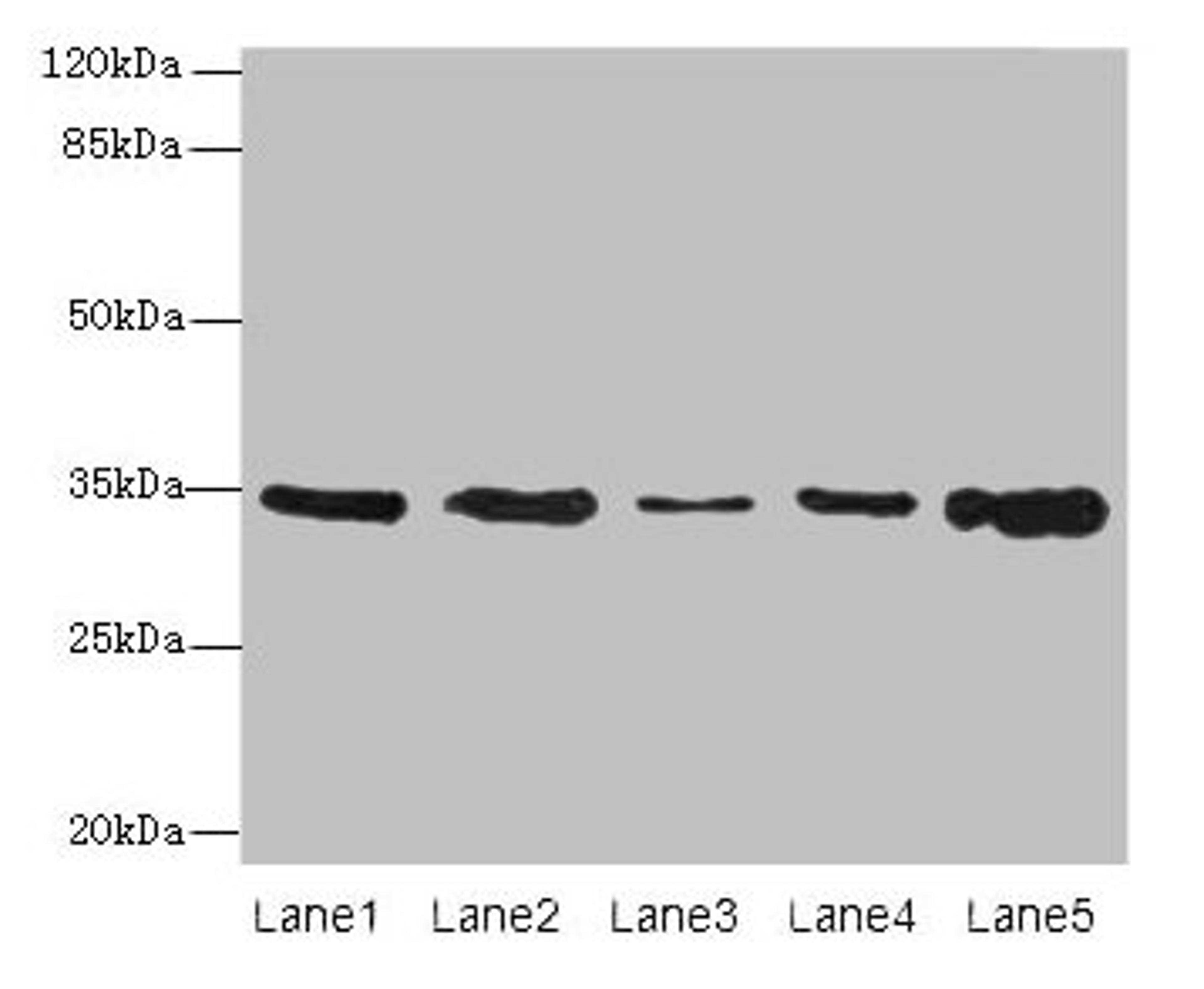 Western blot. All lanes: UCP3 antibody at 0.9µg/ml. Lane 1: Jurkat whole cell lysate. Lane 2: SH-SY5Y whole cell lysate. Lane 3: U251 whole cell lysate. Lane 4: A549 whole cell lysate. Lane 5: Hela whole cell lysate. Secondary. Goat polyclonal to rabbit IgG at 1/10000 dilution. Predicted band size: 35, 30, 23 kDa. Observed band size: 35 kDa