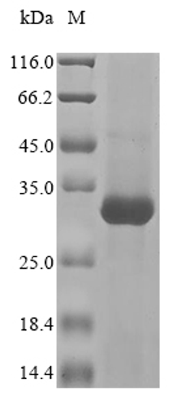 (Tris-Glycine gel) Discontinuous SDS-PAGE (reduced) with 5% enrichment gel and 15% separation gel.