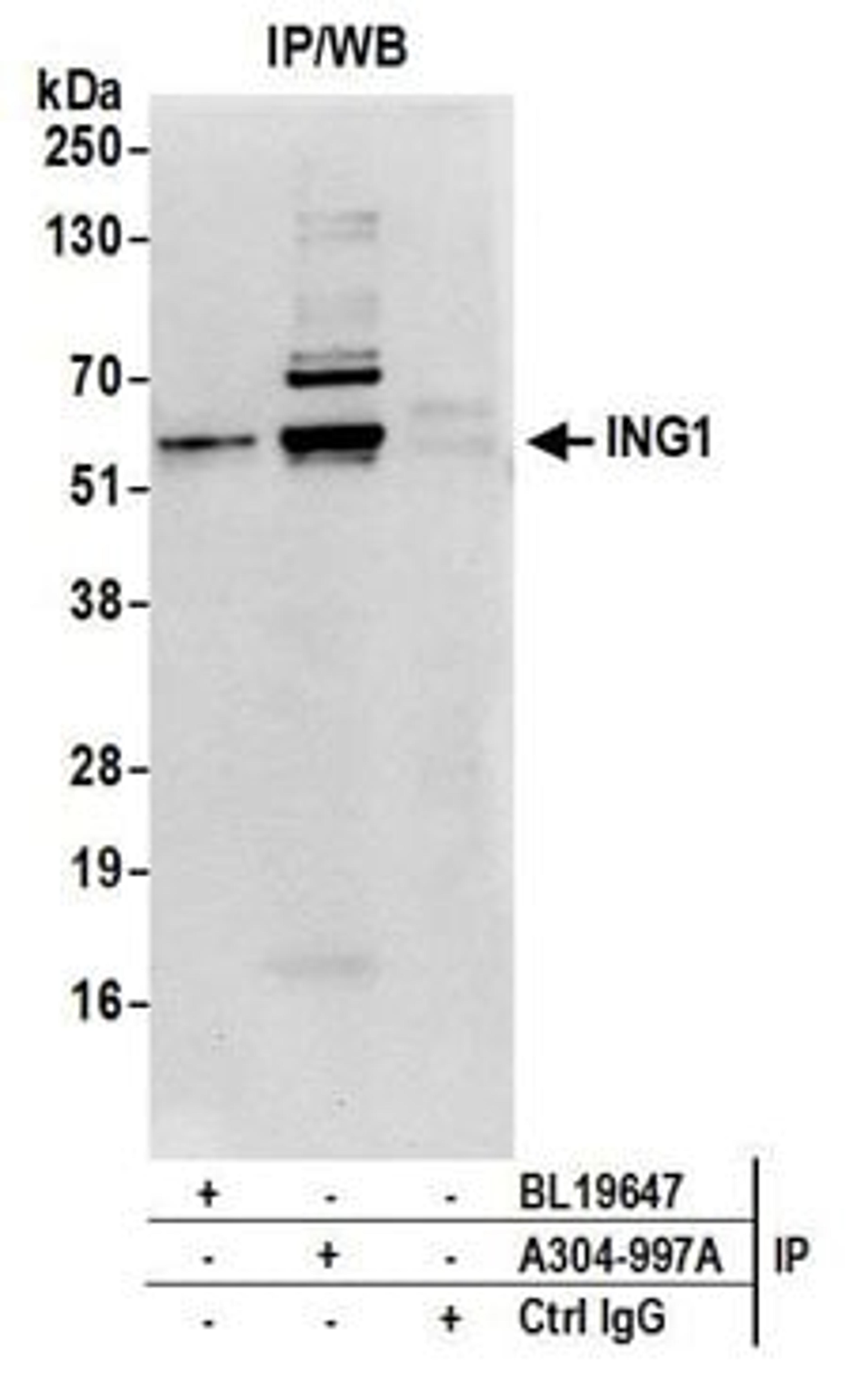 Detection of human ING1 by western blot of immunoprecipitates.