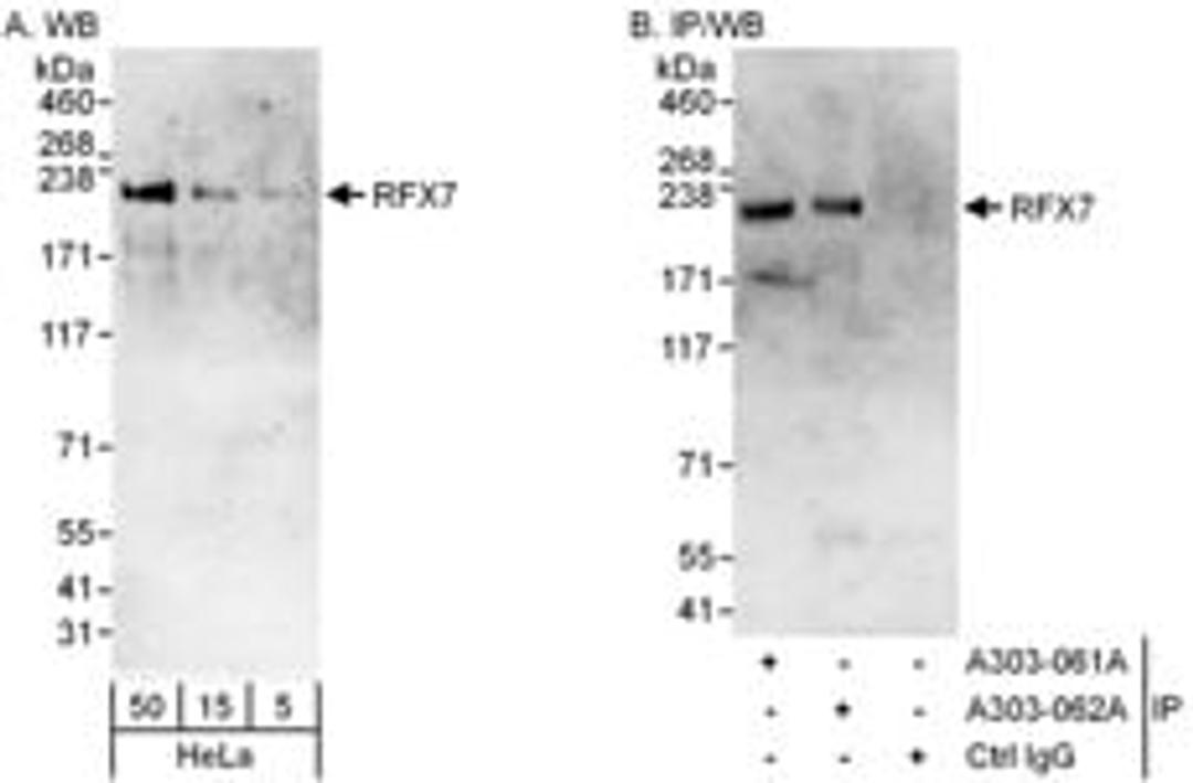 Detection of human RFX7 by western blot and immunoprecipitation.