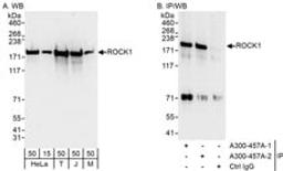 Detection of human and mouse ROCK1 by western blot and immunoprecipitation.