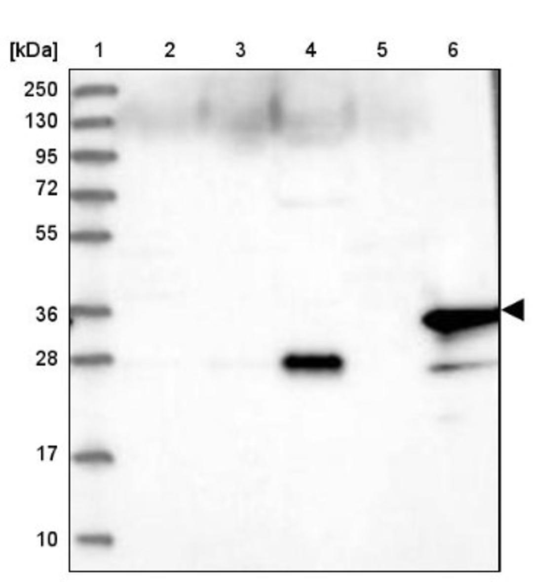 Western Blot: Myozenin 1 Antibody [NBP1-85439] - Lane 1: Marker [kDa] 250, 130, 95, 72, 55, 36, 28, 17, 10<br/>Lane 2: Human cell line RT-4<br/>Lane 3: Human cell line U-251MG sp<br/>Lane 4: Human plasma (IgG/HSA depleted)<br/>Lane 5: Human liver tissue<br/>Lane 6: Human tonsil tissue