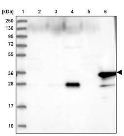 Western Blot: Myozenin 1 Antibody [NBP1-85439] - Lane 1: Marker [kDa] 250, 130, 95, 72, 55, 36, 28, 17, 10<br/>Lane 2: Human cell line RT-4<br/>Lane 3: Human cell line U-251MG sp<br/>Lane 4: Human plasma (IgG/HSA depleted)<br/>Lane 5: Human liver tissue<br/>Lane 6: Human tonsil tissue