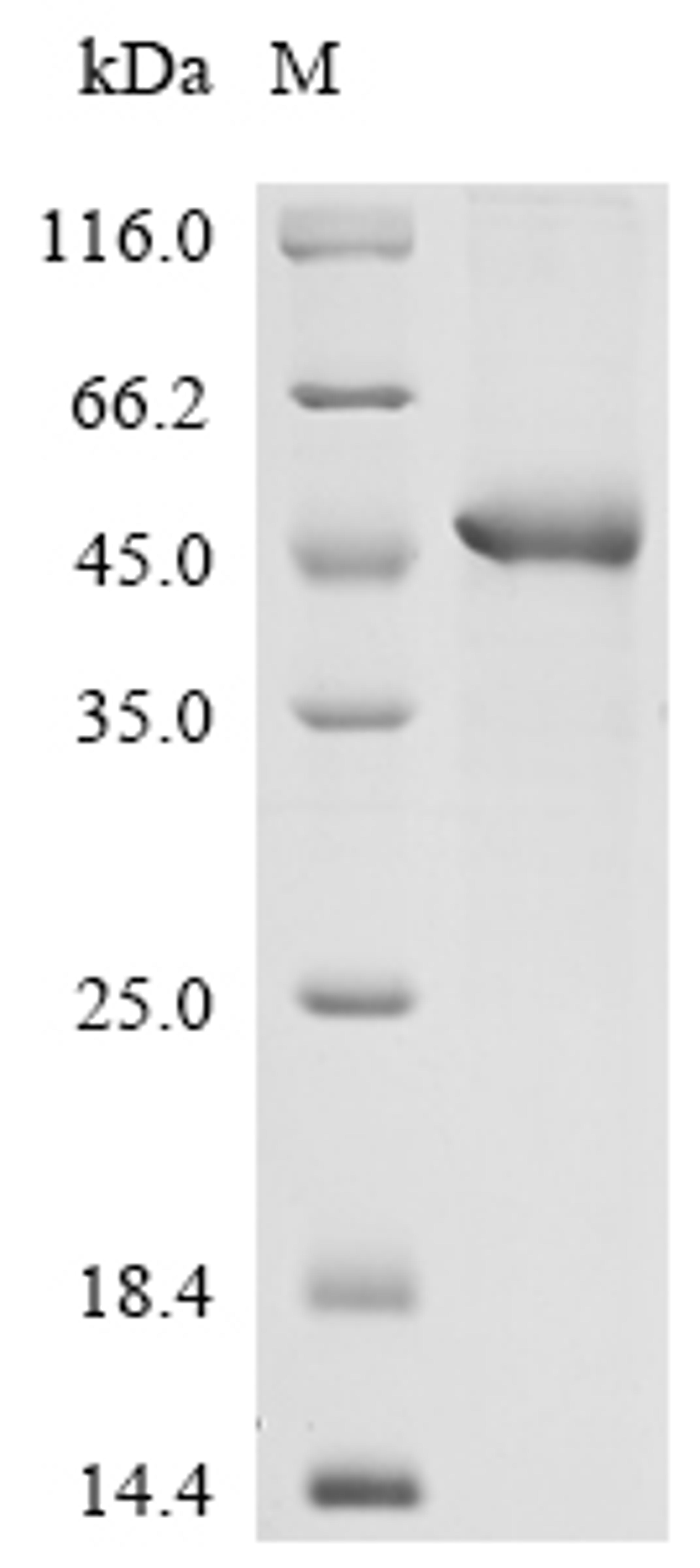 (Tris-Glycine gel) Discontinuous SDS-PAGE (reduced) with 5% enrichment gel and 15% separation gel.