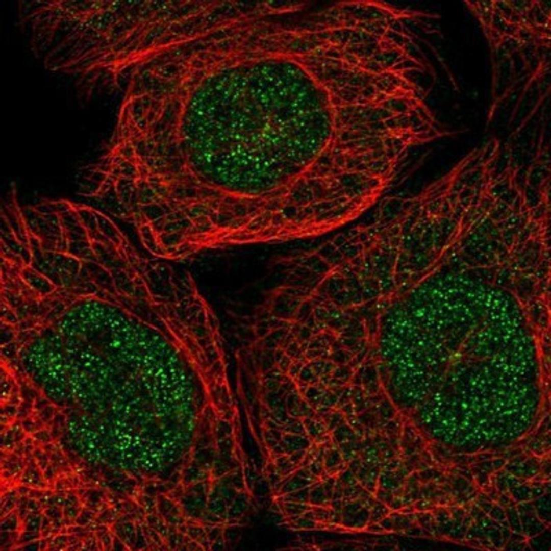 Immunocytochemistry/Immunofluorescence: RNF7 Antibody [NBP1-85594] - Staining of human cell line A-431 shows positivity in nucleus but not nucleoli.