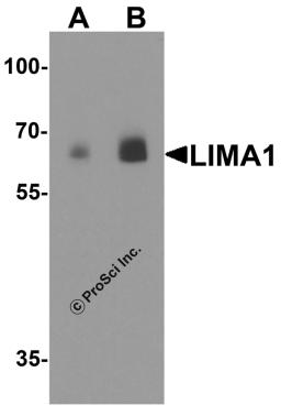 Western blot analysis of LIMA1 in human colon tissue lysate with LIMA1 antibody at (A) 0.5 and (B) 1 &#956;g/ml.