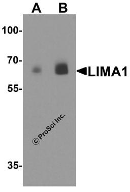 Western blot analysis of LIMA1 in human colon tissue lysate with LIMA1 antibody at (A) 0.5 and (B) 1 μg/ml.