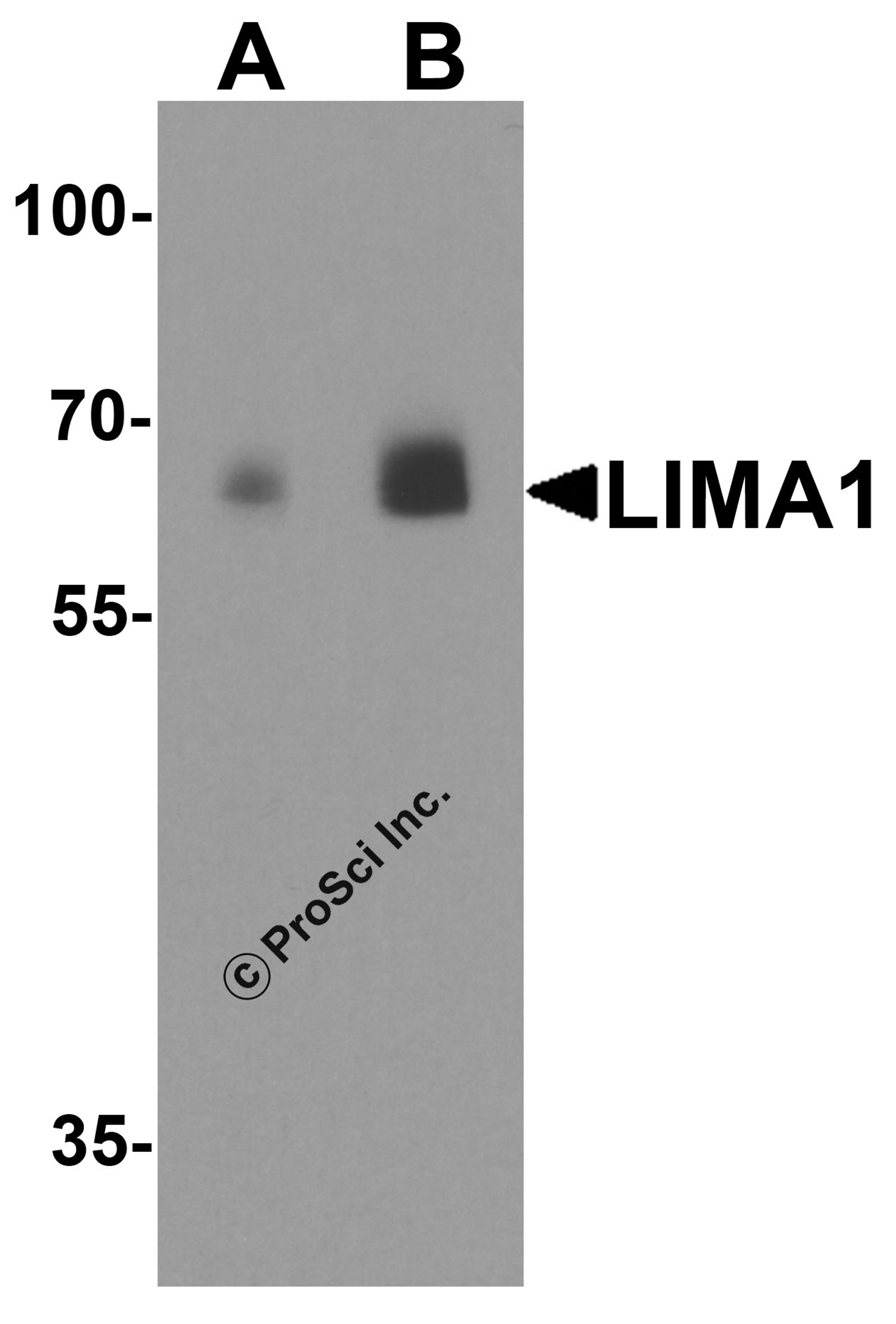 Western blot analysis of LIMA1 in human colon tissue lysate with LIMA1 antibody at (A) 0.5 and (B) 1 μg/ml.