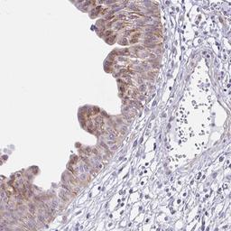 Immunohistochemistry: ANKRD62 Antibody [NBP2-32495] - Staining of human urinary bladder shows moderate cytoplasmic positivity in urothelial cells.