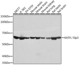 Western blot - KAT9 / Elp3 Rabbit mAb (A0020)