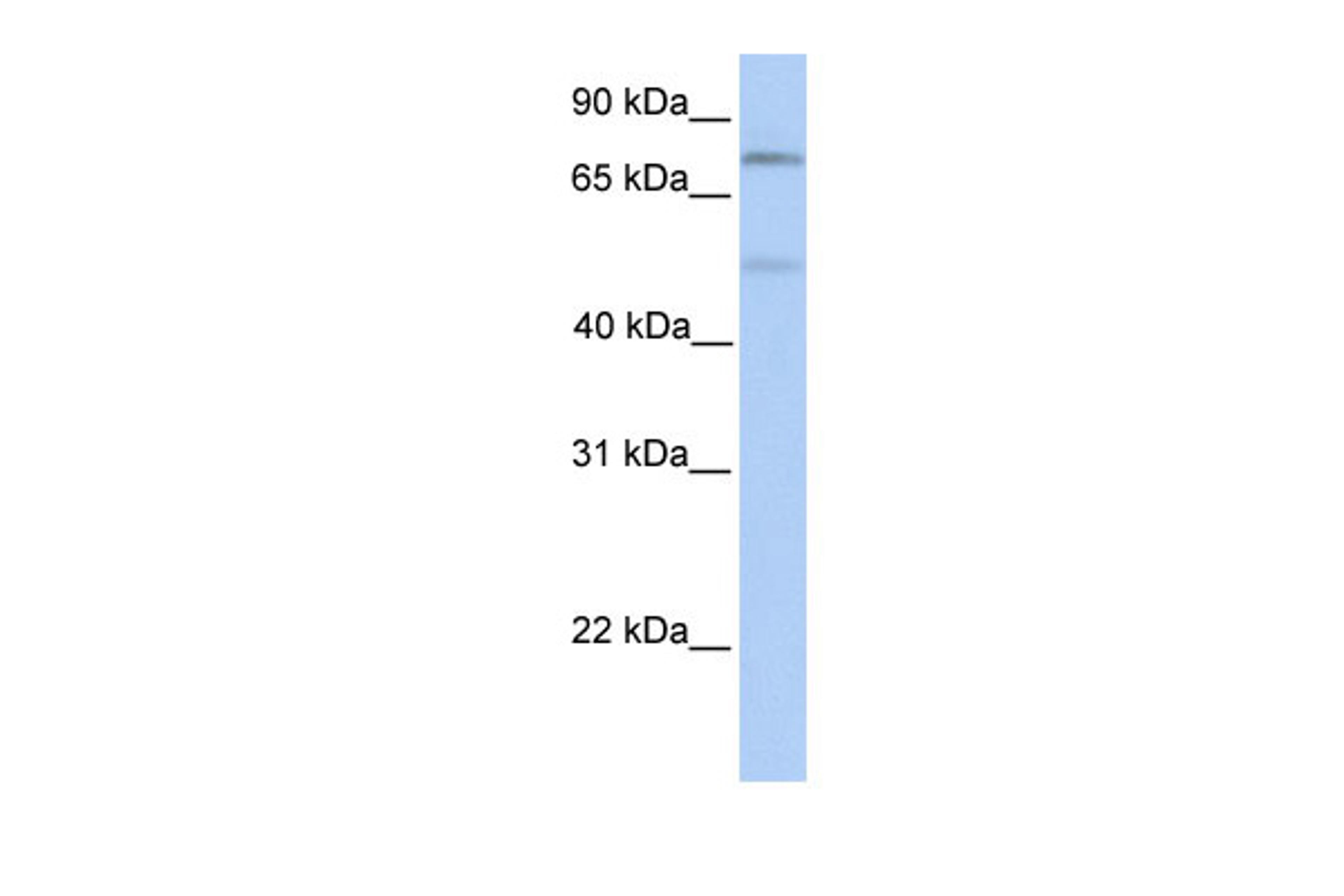 Antibody used in WB on Human Muscle at 0.2-1 ug/ml.