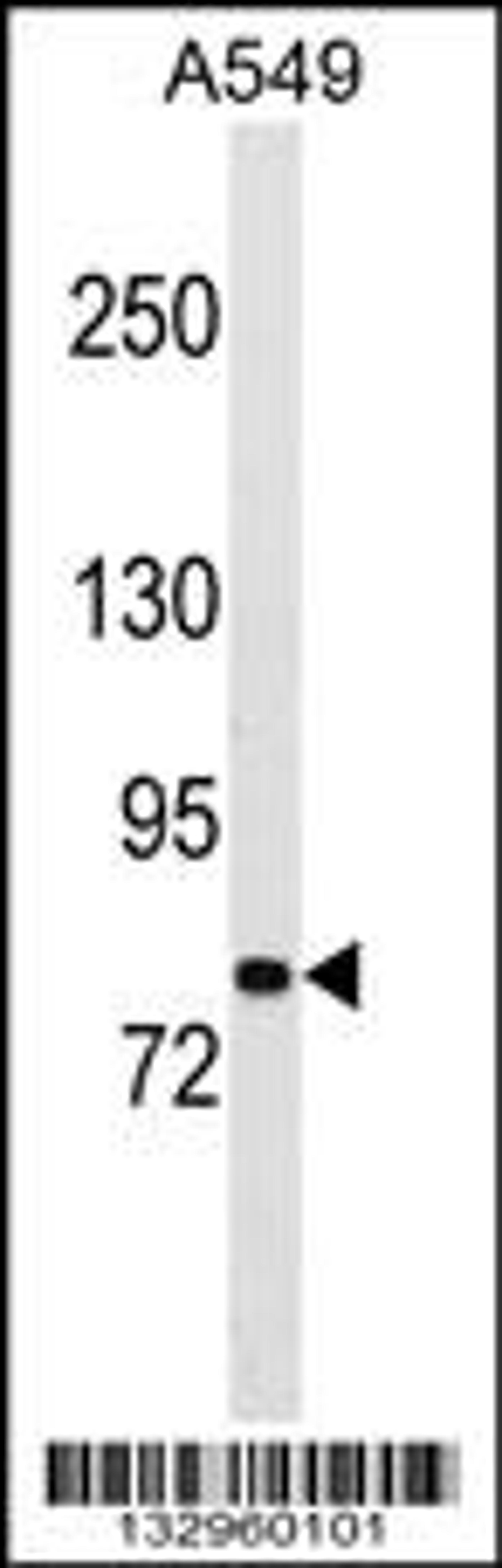 Western blot analysis in A549 cell line lysates (35ug/lane).