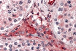 Immunohistochemistry of PTCHD2 in human testis tissue with PTCHD2 antibody at 5 &#956;g/mL.