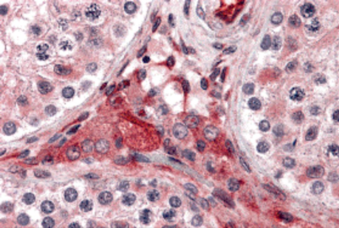 Immunohistochemistry of PTCHD2 in human testis tissue with PTCHD2 antibody at 5 μg/mL.