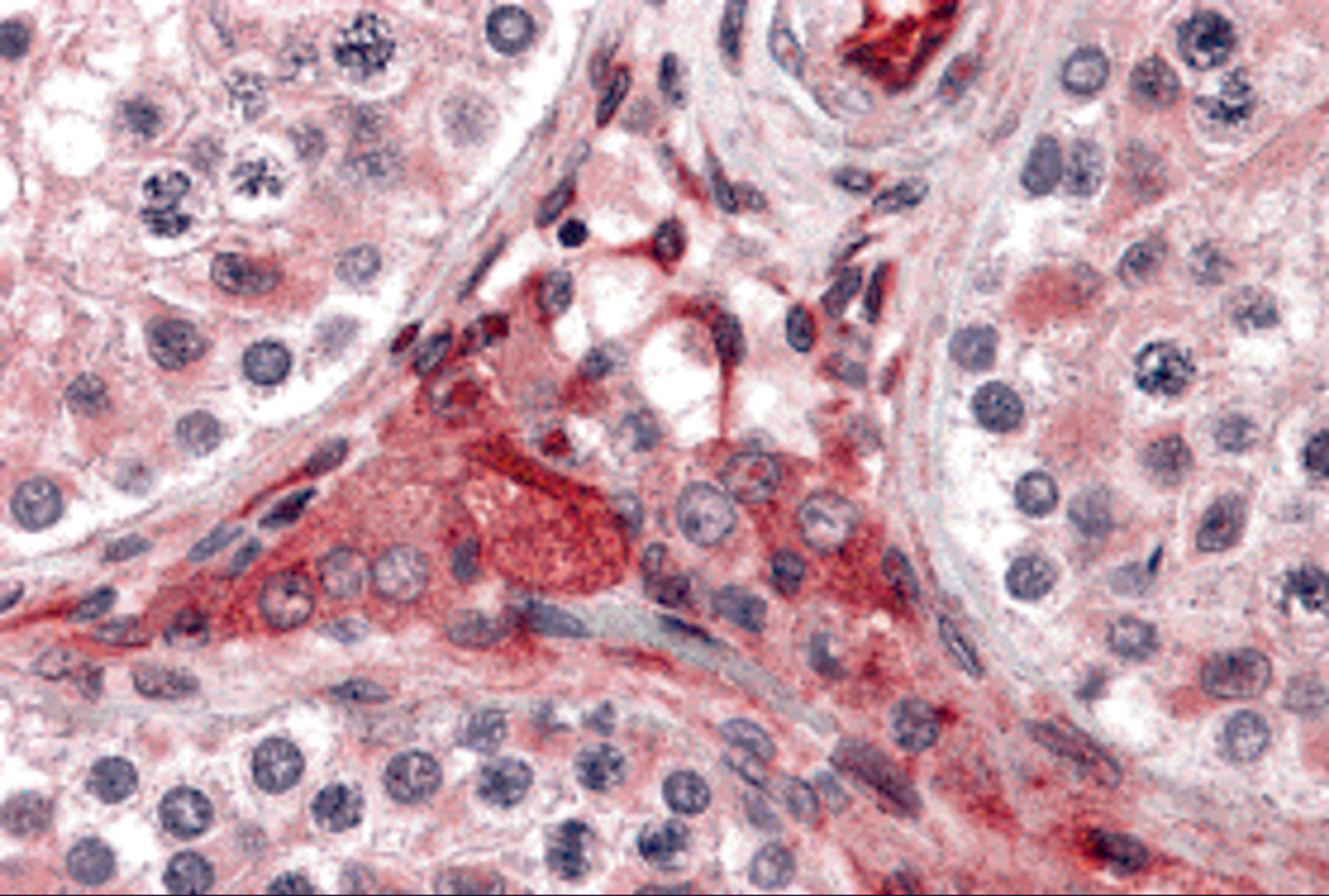 Immunohistochemistry of PTCHD2 in human testis tissue with PTCHD2 antibody at 5 μg/mL.
