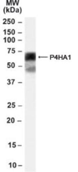 Western Blot: P4HA1 Antibody [NB100-57852] - Analysis of P4HA1 in HEK293 cell lysate (35ug protein in RIPA buffer) using NB100-57852 at 0.1ug/ml.