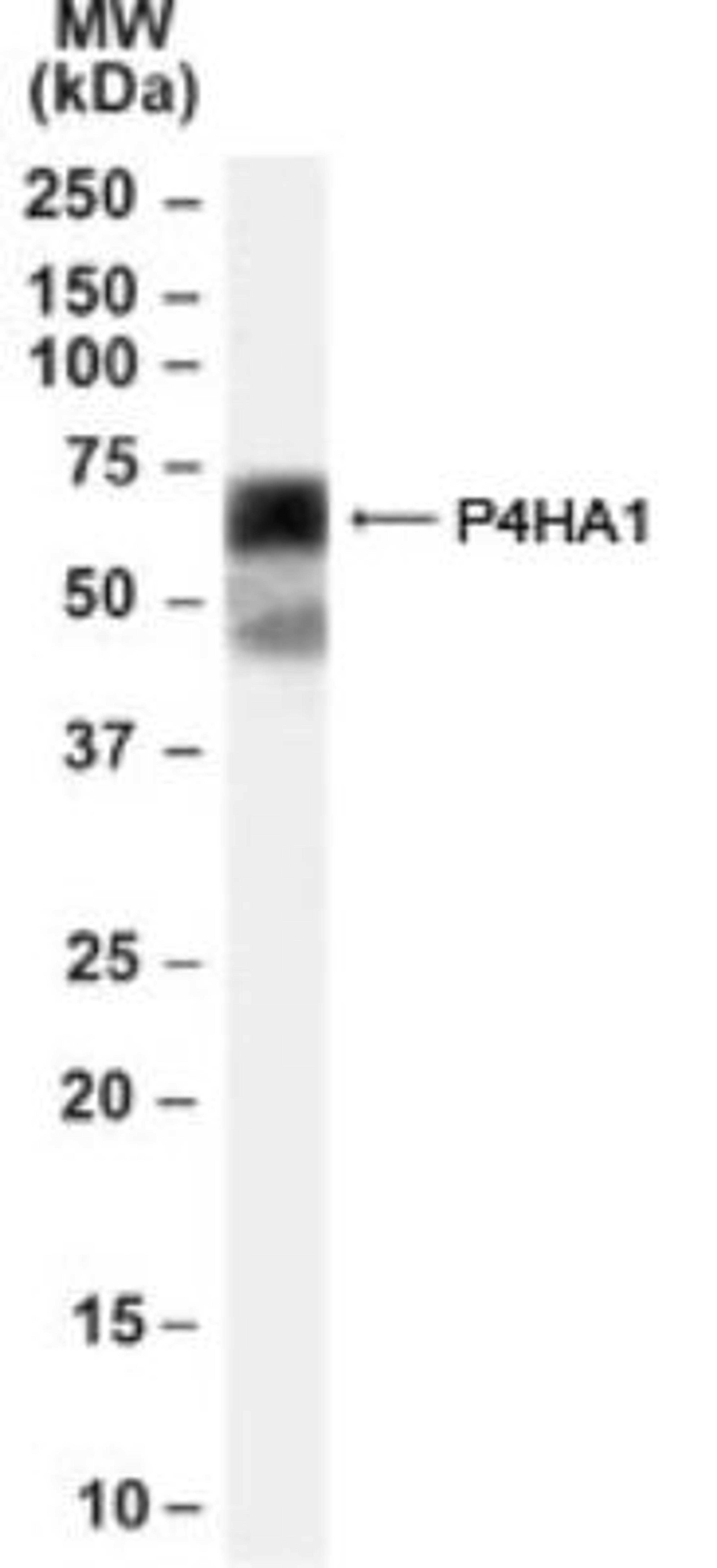 Western Blot: P4HA1 Antibody [NB100-57852] - Analysis of P4HA1 in HEK293 cell lysate (35ug protein in RIPA buffer) using NB100-57852 at 0.1ug/ml.