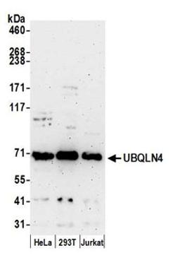 Detection of human UBQLN4 by western blot.