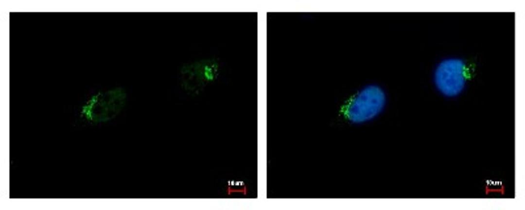 Immunocytochemistry/Immunofluorescence: GALNT7 Antibody [NBP1-32491] - Sample: HeLa cells were fixed in 4% paraformaldehyde at RT for 15 min. Green: GALNT7 protein stained by GALNT7 antibody diluted at 1:500. Blue: Hoechst 33343 staining.