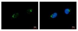 Immunocytochemistry/Immunofluorescence: GALNT7 Antibody [NBP1-32491] - Sample: HeLa cells were fixed in 4% paraformaldehyde at RT for 15 min. Green: GALNT7 protein stained by GALNT7 antibody diluted at 1:500. Blue: Hoechst 33343 staining.