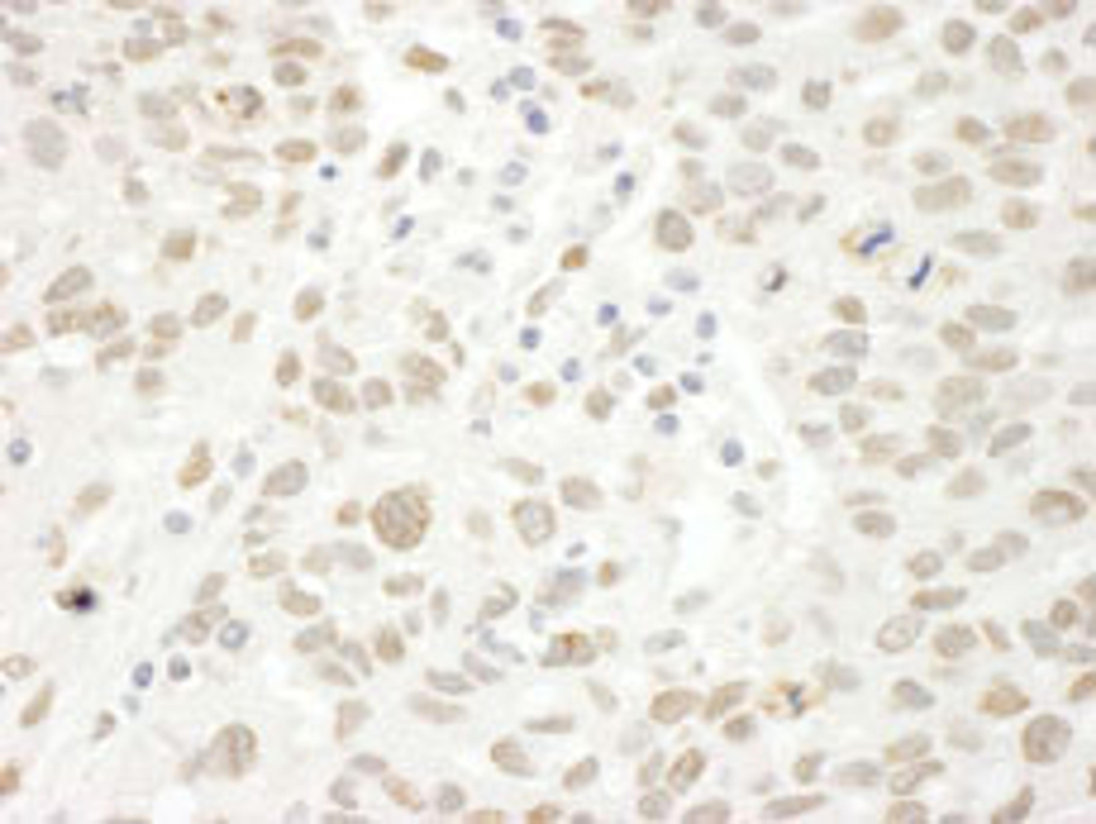 Detection of human ARID4B by immunohistochemistry.