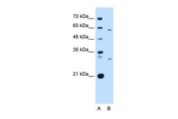 Antibody used in WB on Human HepG2 at 1 ug/ml.