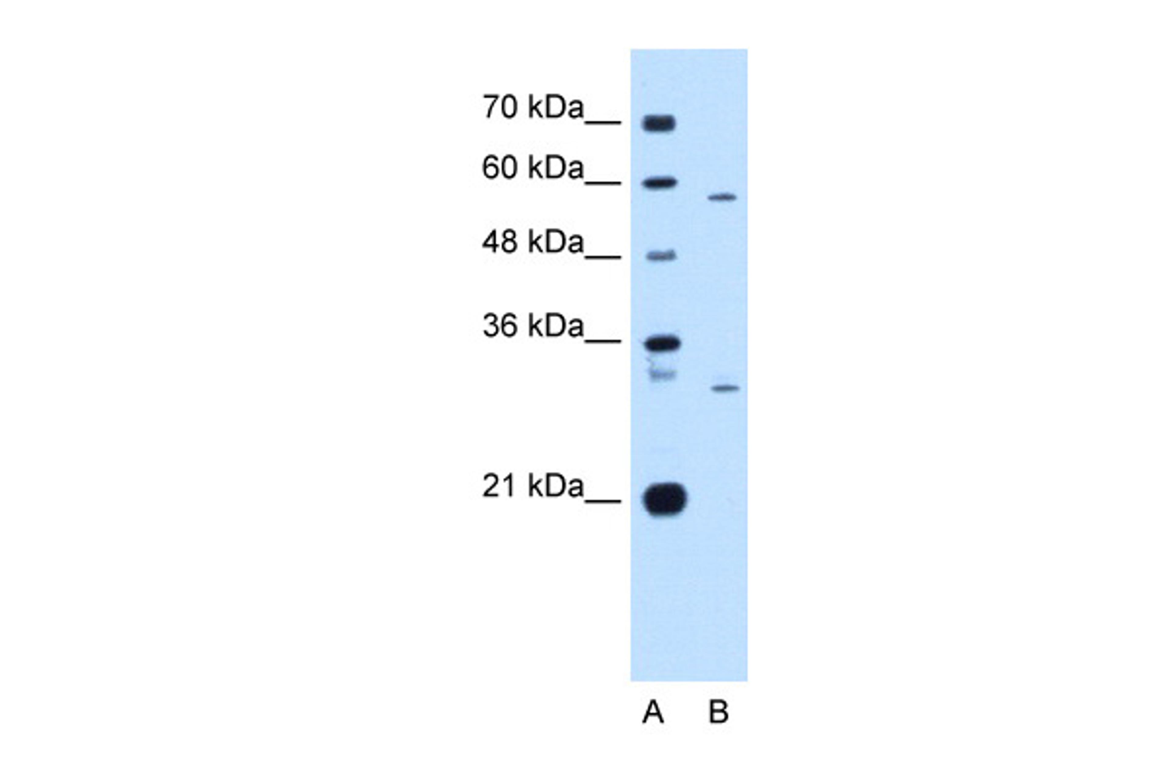 Antibody used in WB on Human HepG2 at 1 ug/ml.