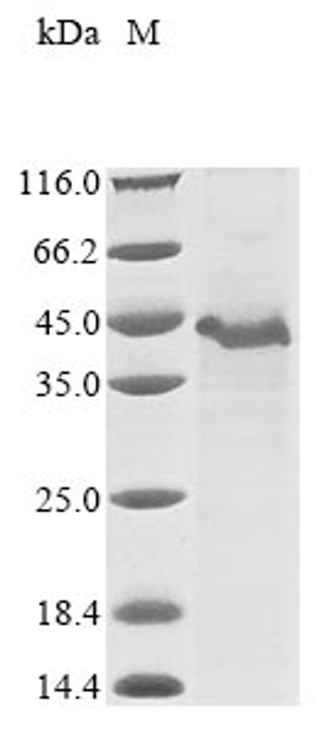 (Tris-Glycine gel) Discontinuous SDS-PAGE (reduced) with 5% enrichment gel and 15% separation gel.