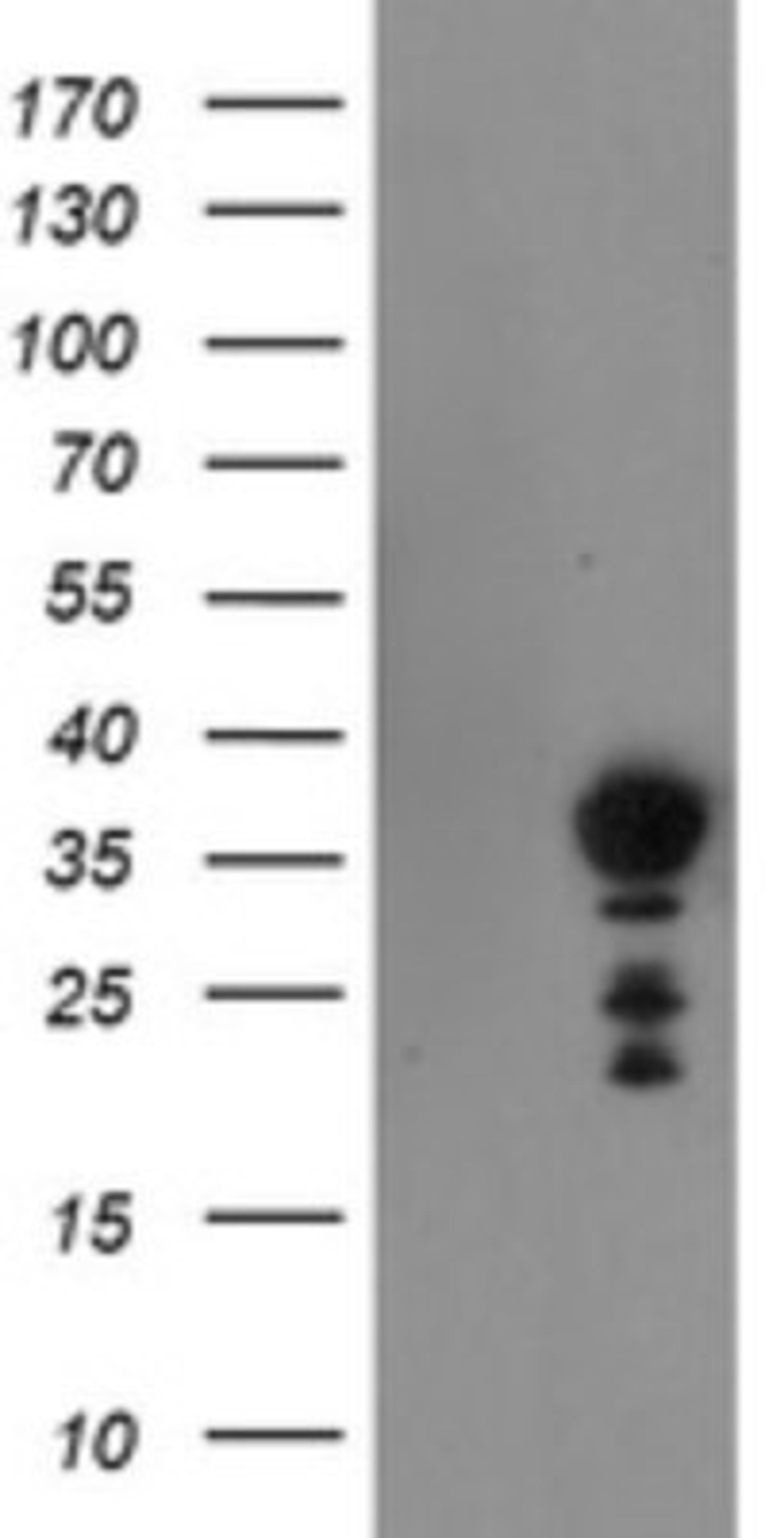 Western Blot: NRIP3 Antibody (1A9) [NBP2-45876] - Analysis of HEK293T cells were transfected with the pCMV6-ENTRY control (Left lane) or pCMV6-ENTRY NRIP3.