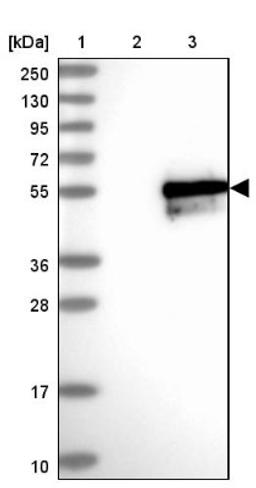 Western Blot: FAM170A Antibody [NBP2-32707] - Lane 1: Marker [kDa] 250, 130, 95, 72, 55, 36, 28, 17, 10<br/>Lane 2: Negative control (vector only transfected HEK293T lysate)<br/>Lane 3: Over-expression lysate (Co-expressed with a C-terminal myc-DDK tag (~3.1 kDa) in mammalian HEK293T cells, LY405332)