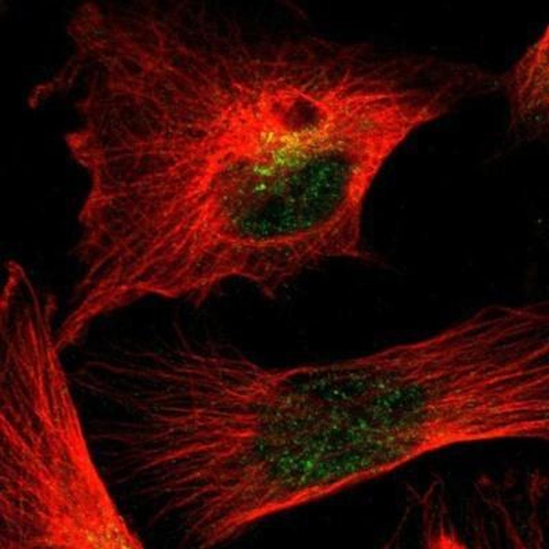 Immunocytochemistry/Immunofluorescence: HPGD Antibody [NBP1-87062] - Staining of human cell line U-251MG shows positivity in nucleus but not nucleoli & cytoplasm.