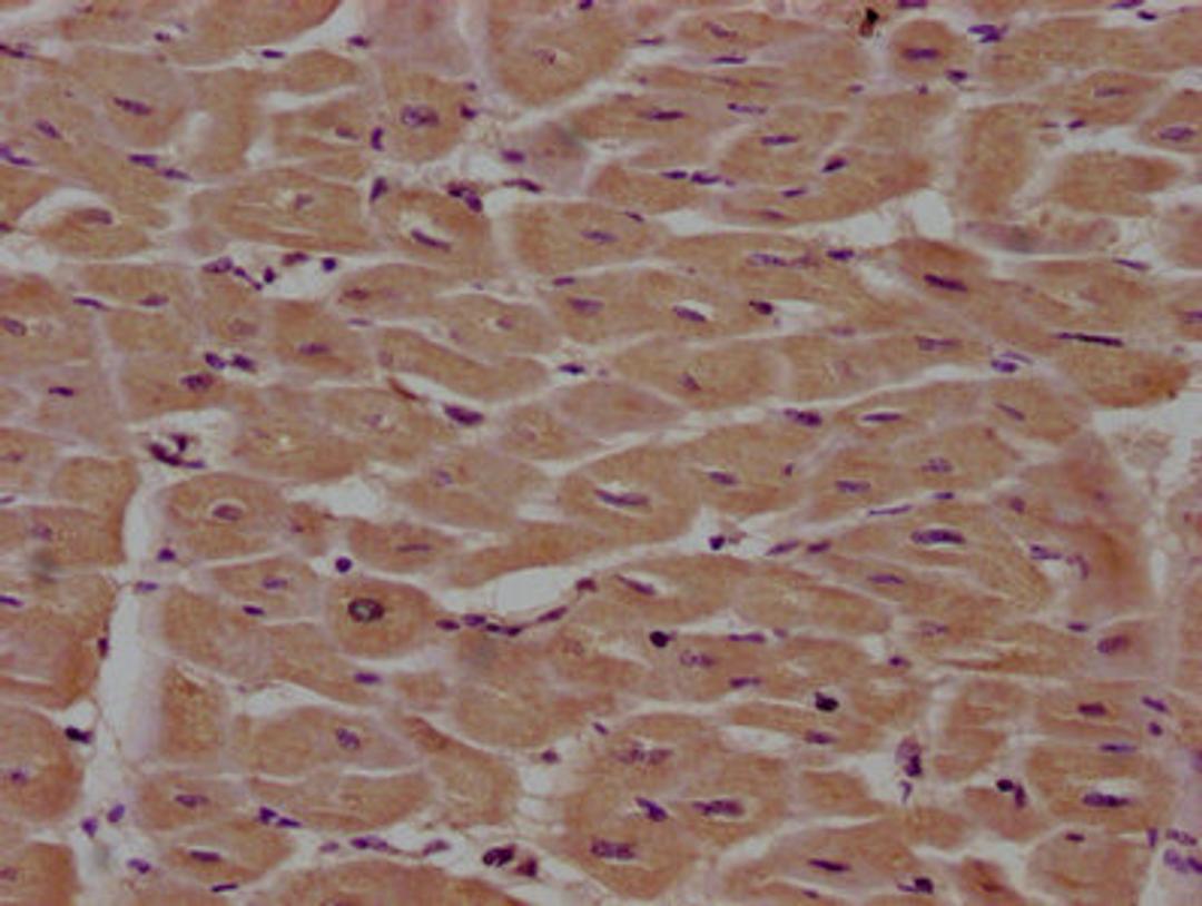 IHC image of CSB-PA018035LA01HU diluted at 1:100 and staining in paraffin-embedded human heart tissue performed on a Leica BondTM system. After dewaxing and hydration, antigen retrieval was mediated by high pressure in a citrate buffer (pH 6.0). Section was blocked with 10% normal goat serum 30min at RT. Then primary antibody (1% BSA) was incubated at 4°C overnight. The primary is detected by a biotinylated secondary antibody and visualized using an HRP conjugated SP system.