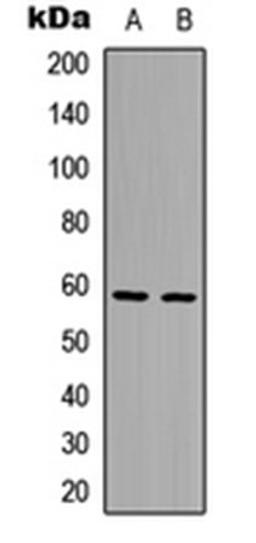 Western blot analysis of HepG2 (Lane1), HeLa (Lane2) whole cell using AIOLOS antibody