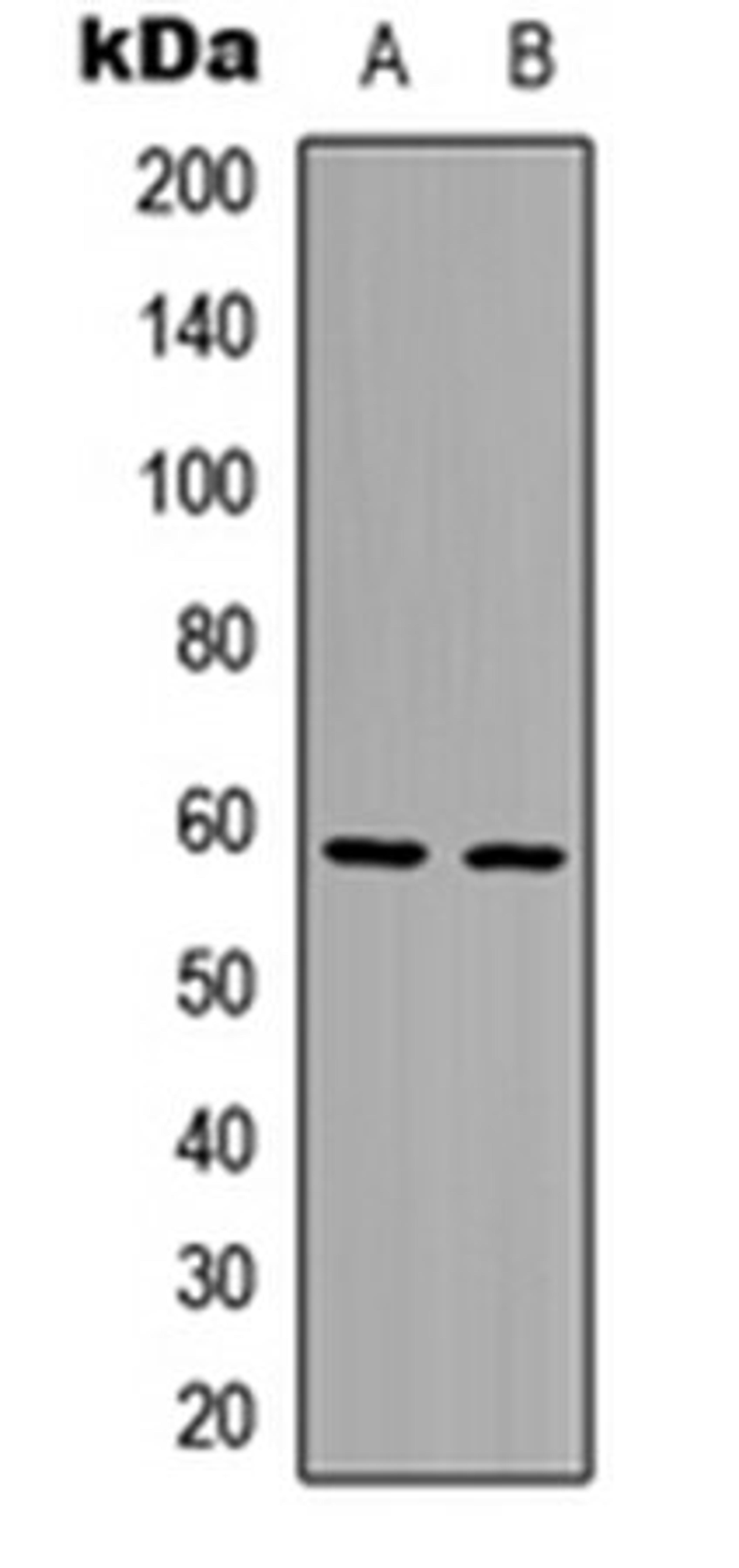 Western blot analysis of HepG2 (Lane1), HeLa (Lane2) whole cell using AIOLOS antibody