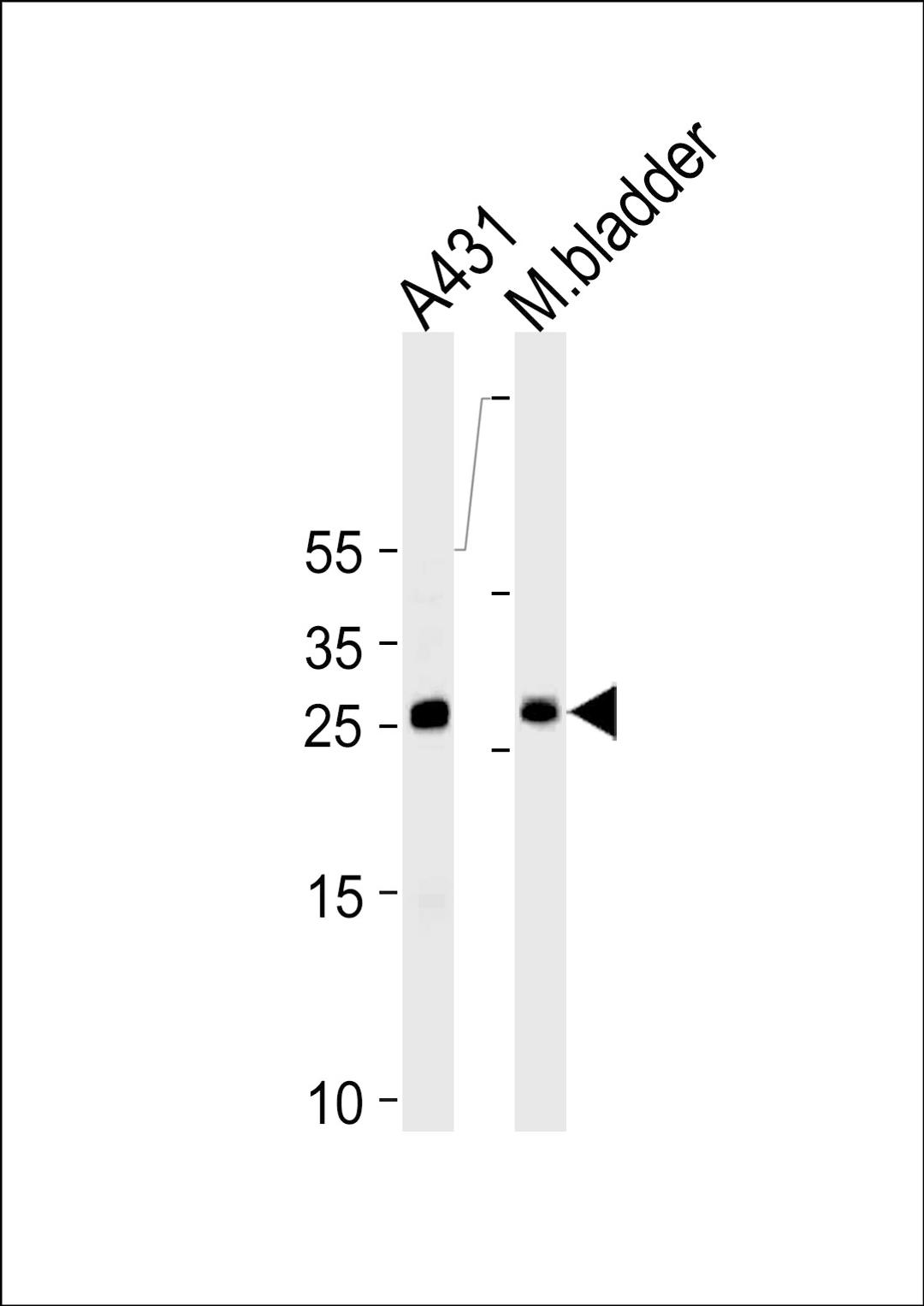 Western blot analysis in A431 cell line and mouse bladder tissue lysates (35ug/lane).