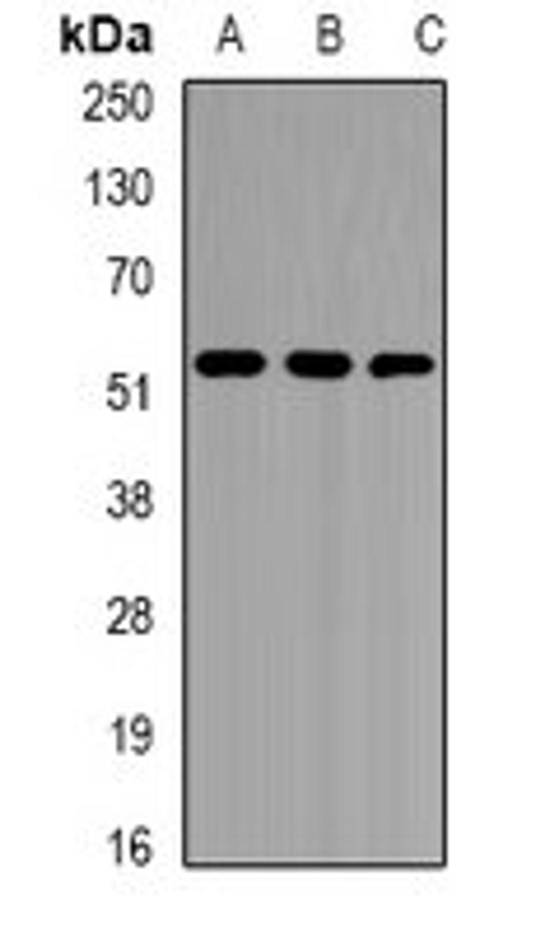 Western blot analysis of Jurkat (Lane1), K562 (Lane2), mouse liver (Lane3) whole cell lysates using EPHX1 antibody