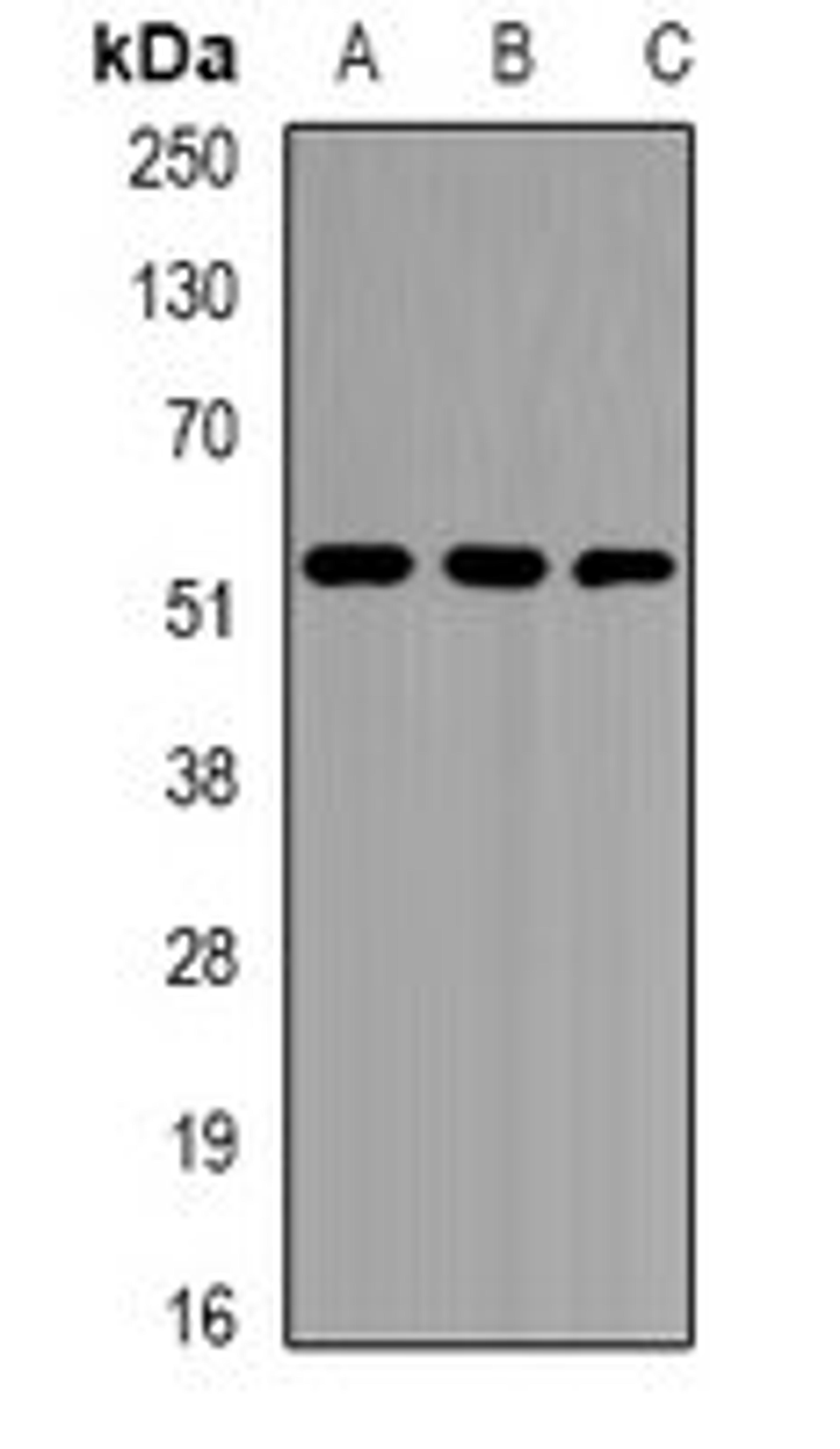 Western blot analysis of Jurkat (Lane1), K562 (Lane2), mouse liver (Lane3) whole cell lysates using EPHX1 antibody