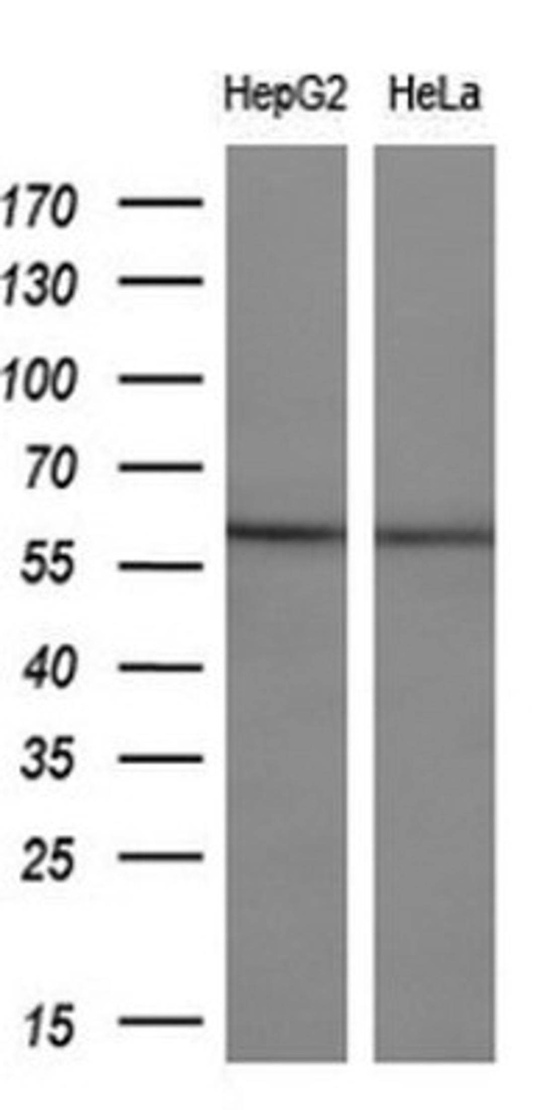 Western Blot: ETS2 Antibody (2A3) [NBP2-45543] - Analysis of extracts (10ug) from 2 different cell lines.