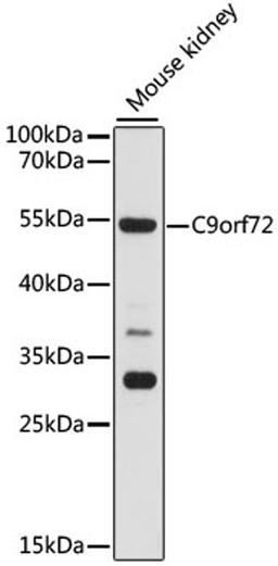 Western blot - C9orf72 antibody (A15970)