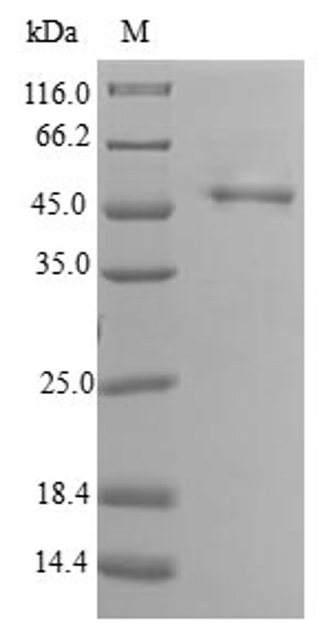 (Tris-Glycine gel) Discontinuous SDS-PAGE (reduced) with 5% enrichment gel and 15% separation gel.