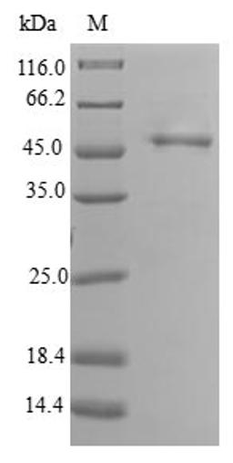 (Tris-Glycine gel) Discontinuous SDS-PAGE (reduced) with 5% enrichment gel and 15% separation gel.