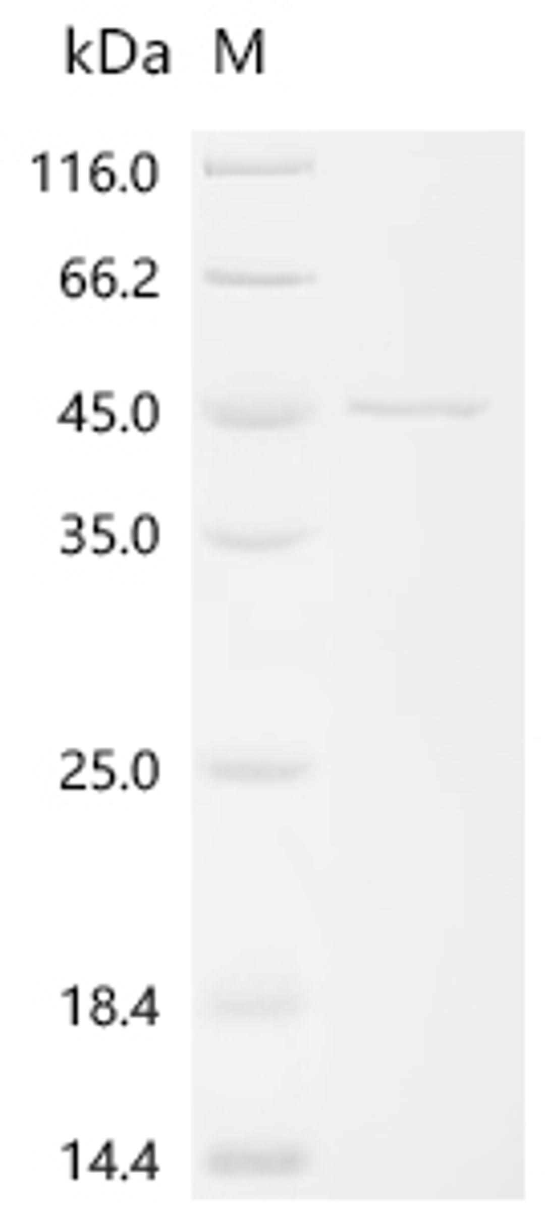 (Tris-Glycine gel) Discontinuous SDS-PAGE (reduced) with 5% enrichment gel and 15% separation gel.