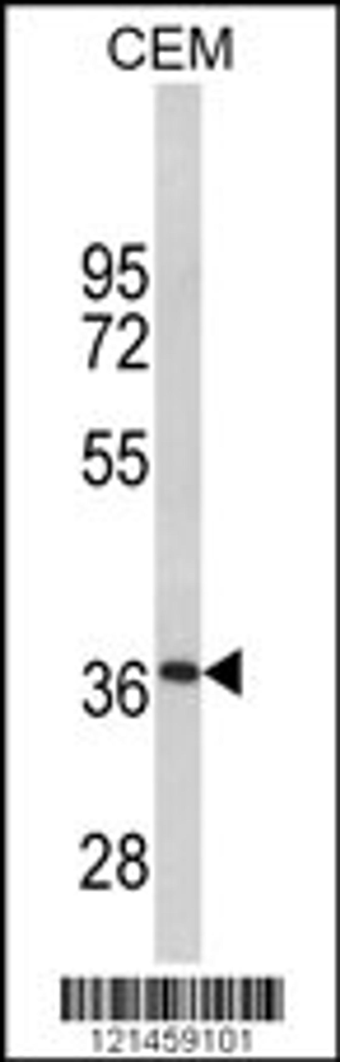 Western blot analysis of MPZ Antibody in CEM cell line lysates (35ug/lane)