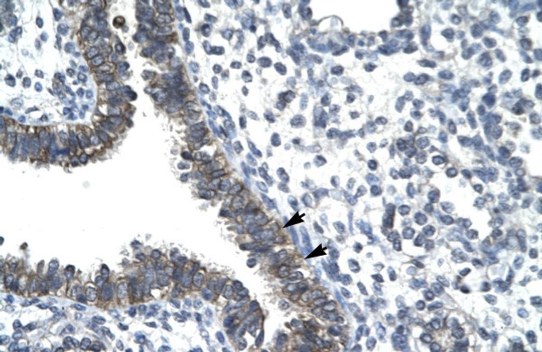 Antibody used in IHC on Human Lung.