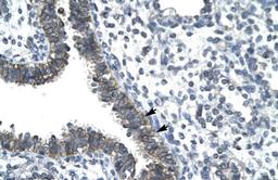 Antibody used in IHC on Human Lung.