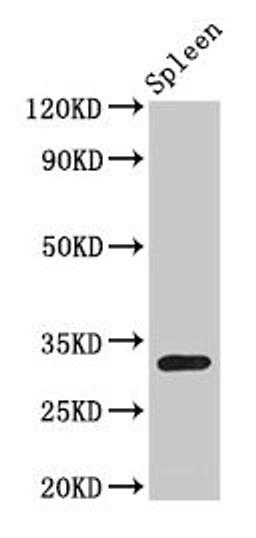 Western Blot. Positive WB detected in: Rat spleen tissue. All lanes: H1F0 antibody at 1.5µg/ml. Secondary. Goat polyclonal to rabbit IgG at 1/50000 dilution. Predicted band size: 21, 20 kDa. Observed band size: 32 kDa
