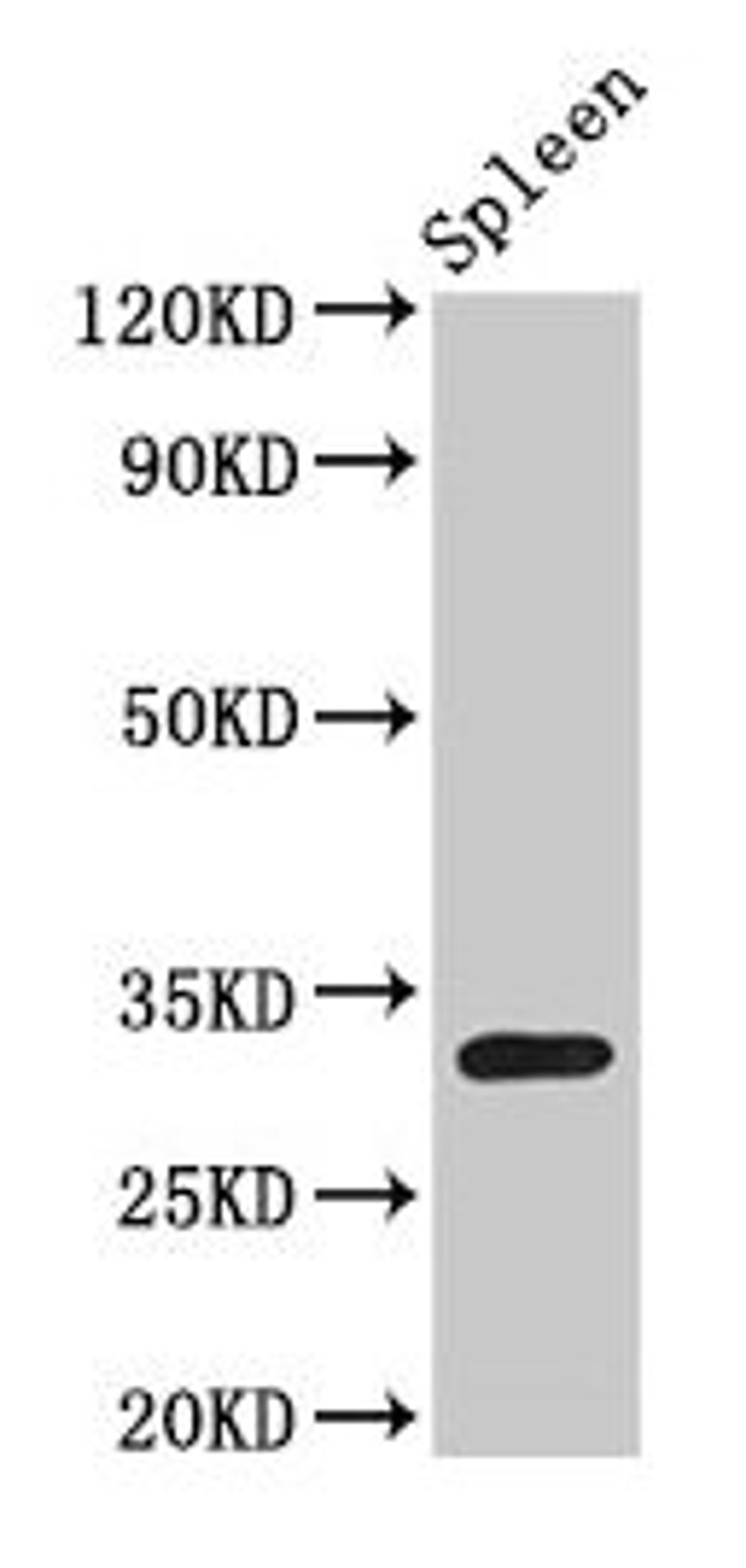 Western Blot. Positive WB detected in: Rat spleen tissue. All lanes: H1F0 antibody at 1.5µg/ml. Secondary. Goat polyclonal to rabbit IgG at 1/50000 dilution. Predicted band size: 21, 20 kDa. Observed band size: 32 kDa