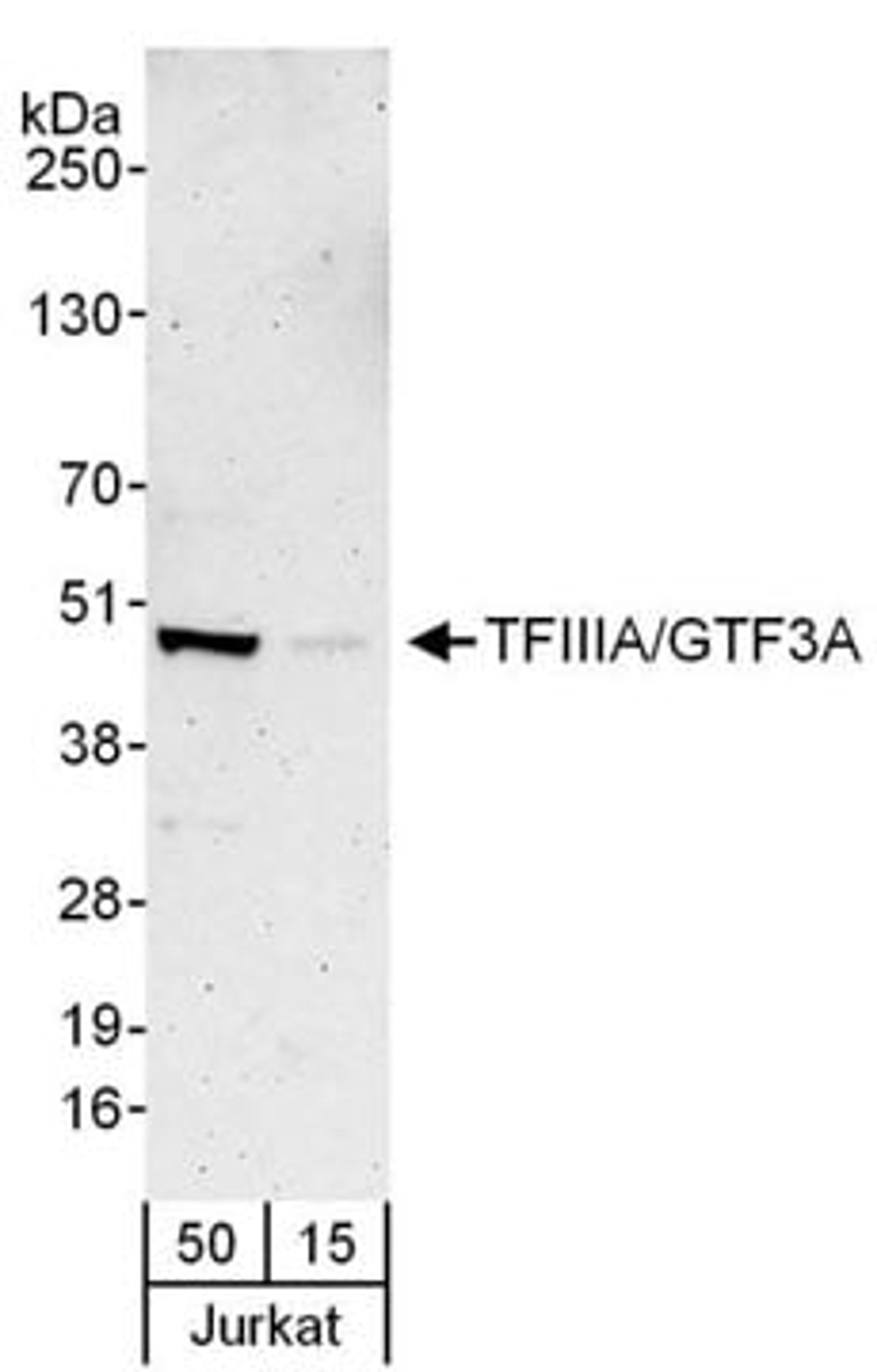 Detection of human TFIIIA/GTF3A by western blot.