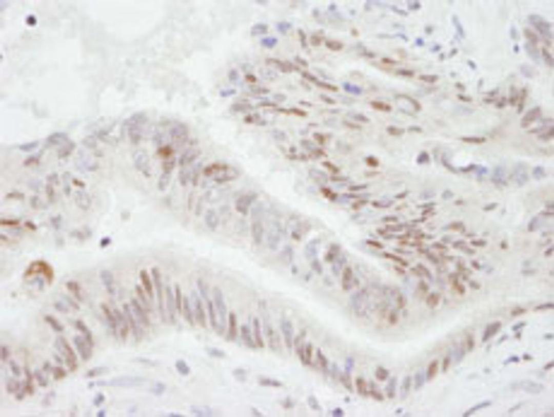 Detection of human PGC-1 by immunohistochemistry.